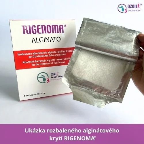 RIGENOMA® alginátové krytí s OZOILE® 5 ks