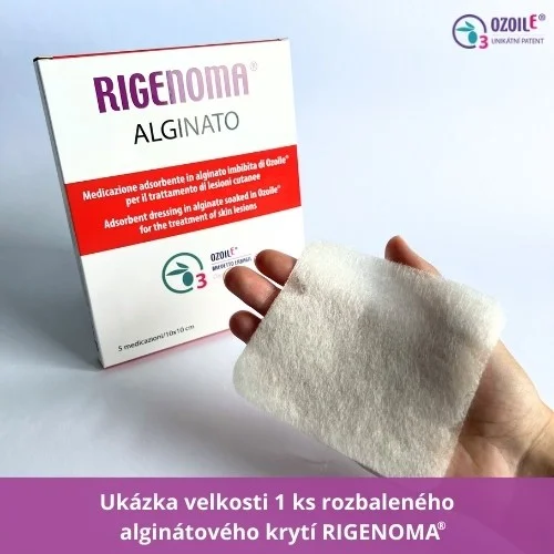 RIGENOMA® alginátové krytí s OZOILE® 5 ks